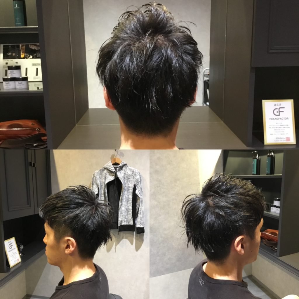 メンズに人気の髪型は刈上げとツーブロックのすっきりショートヘア 薄毛対策に特化した完全個室のメンズ美容室 シェアオム 香川県高松市