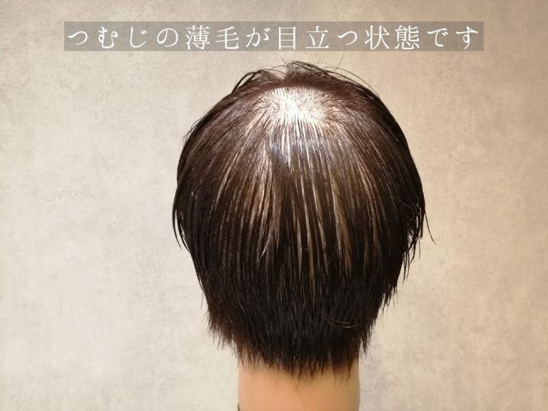 頭頂部の薄毛を簡単にカバーできるスタイリング方法とは 薄毛対策に特化した完全個室のメンズ美容室 シェアオム 香川県高松市