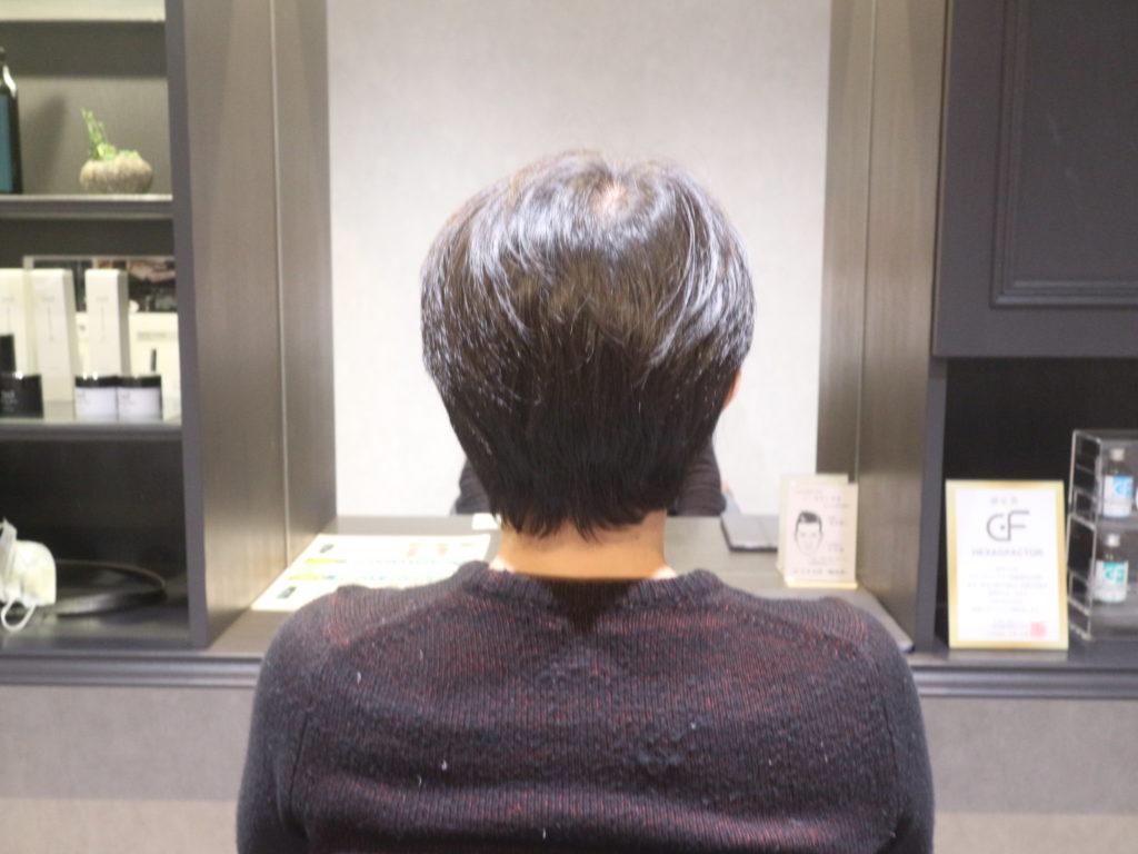 カットモデルのビフォーアフターご紹介します 薄毛対策に特化した完全個室のメンズ美容室 シェアオム 香川県高松市